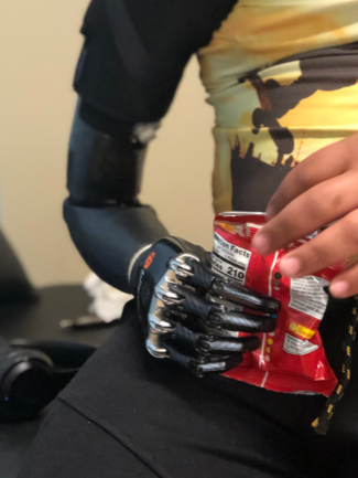 Ottobock bebionic hand with dynamic elbow